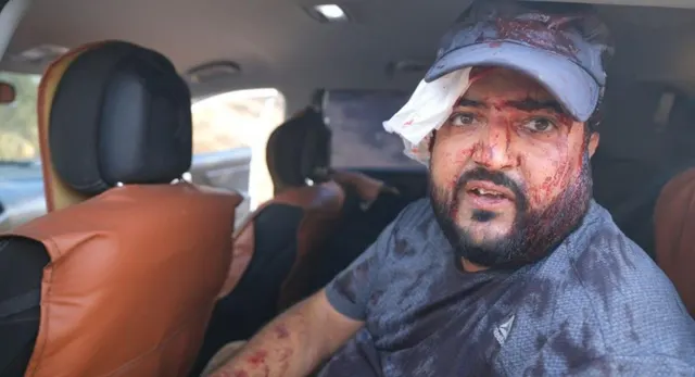 US Journalist Beaten by Israeli Settlers During West Bank Olive Harvest Attack